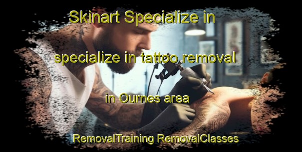 Skinart Specialize in specialize in tattoo removal in Ournes area | #RemovalTraining #RemovalClasses #SkinartTraining-France