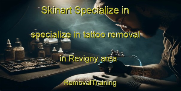 Skinart Specialize in specialize in tattoo removal in Revigny area | RemovalTraining | RemovalClasses | SkinartTraining-France